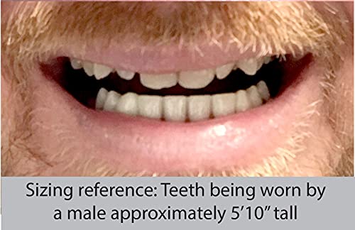 Instant Smile Professional Cosmetic Lower Teeth - New from Hand crafted detail, custom fit at home!