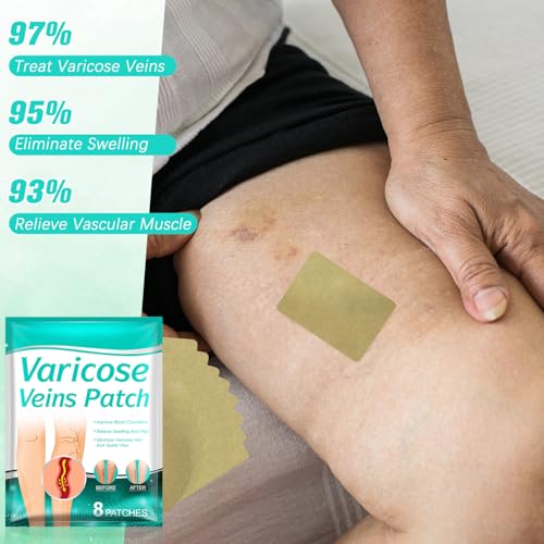 16Pcs LegRenew Varicose Veins Patch,Professional Varicose Veins Soothing Patch for Legs,Varicose Vein Patchs for Legs,Naturally Improves the Appearanceof Leg,Comfortable,Safe and Easy to Use