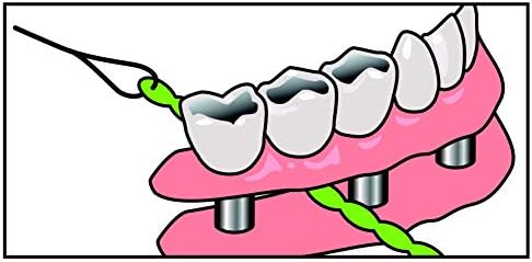 Brace X-Floss, Green