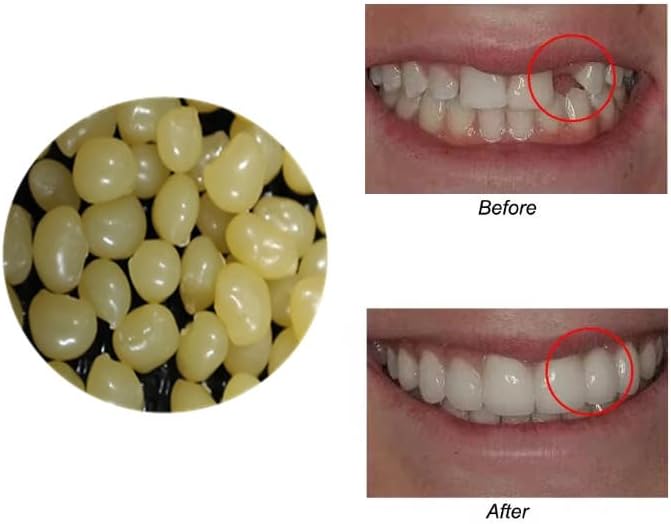 Latest 4 colors Temporary Moldable False Teeth Repair Replacement Thermal Fitting Beads Kit for Teeth Instant Confident Smile Teeth