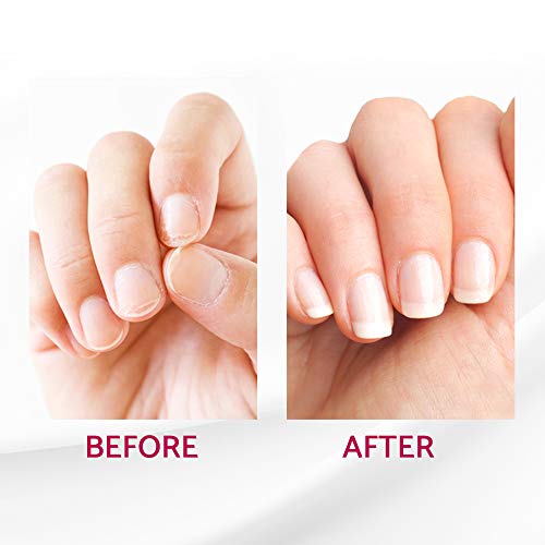 IBD Reconstrux Nail Repair Treatment – Nail Strengthener for Weak & Damaged Nails, Nail Growth Treatment for Peeling & Brittle Nails – 0.125 fl oz, 2 Pack