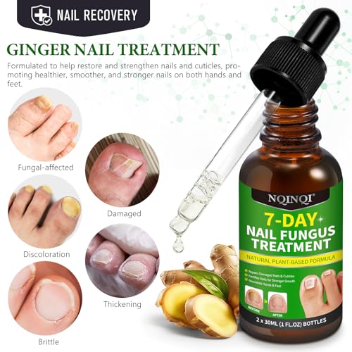 7 Days Nail Fungus Treatment, Fungi Nail Liquid Maximum Strength, Ginger Cuticle Care Oil for Strengthen & Promote Nail Growth (2PCS)