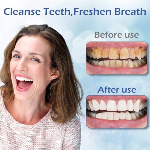 Hydroxyapatite Toothpastes for Enamel Protection and Tooth Strengthening, Gentle Mint, Safe for Sensitive Teeth, Daily Oral Care for Fresh Breath & Oral Health (3)