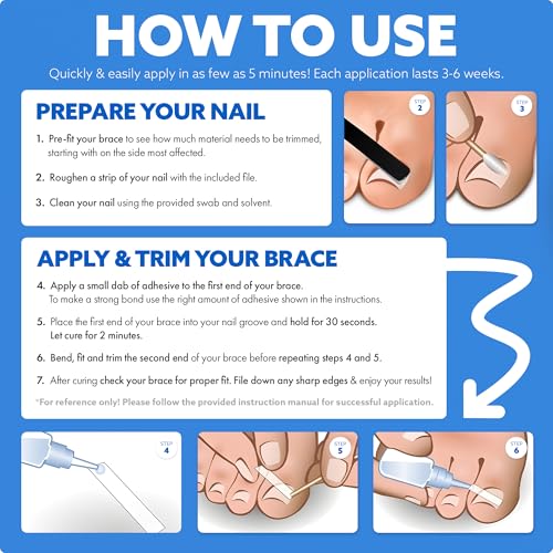 CurveCorrect® Ingrown Toenail Treatment Kit - Ingrown Toenail Corrector Kit with 10 Braces - at Home Ingrown Toenail Correction - Big Toe Ingrown Nail Treatment