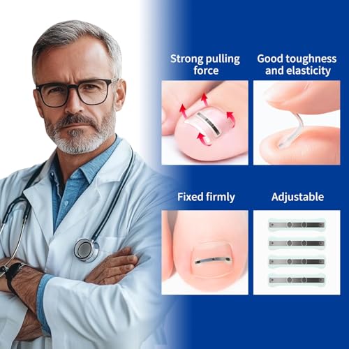 Ingrown Toenail Treatment, 10 packs Titanium Alloy Ingrown Toenail Corrector for all size foot, Ingrown Toenail Removal Kit for Curved Nail Repair, at Home Nail Kit Tools-Blue2