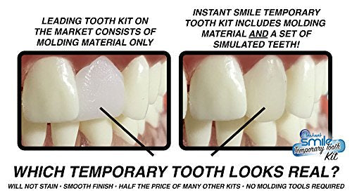 Instant Smile MULTISHADE Patented Temporary Tooth Repair Kit. A Realistic Looking Fix for a Missing or Broken Tooth.