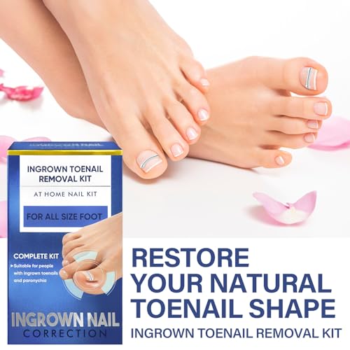 Ingrown Toenail Treatment, 10 packs Titanium Alloy Ingrown Toenail Corrector for All Size Curve Correct Ingrown Toenail, Ingrown Toenail Removal Kit for Straightener of Big Toe
