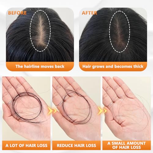 Anti Hair Loss Shampoo - Routine Shampoo for Women Hair Loss, Hair Fall Shampoo Promotes Hair Growth (2pcs)
