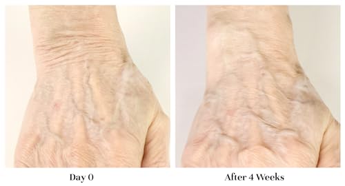 City Beauty Restoring Hand Treatment - Moisturizing Hand Cream - Dry Hand Relief - Solution for Wrinkled, Crepey Hands & Dark Spots - Wash-Resistant - Anti-Aging Cruelty-Free Skin Care