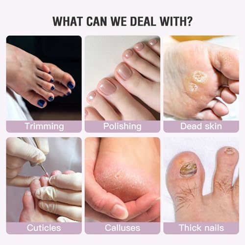 Callus Remover for Feet, Electric Foot Callus Remover - 8 Grinding Heads, 9 Speeds, Rechargeable Foot File - Professional Pedicure Tool for Hard Skin, Calluses & Cracked Feet