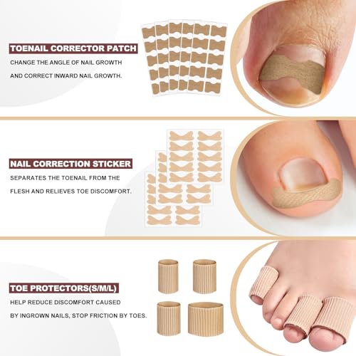 Ingrown Toenail Removal Kit, Professional Ingrown Toenail tool Kit with Ingrown Toenail Corrector, 50PCS Ingrown Toenail Corrector Patch & 30PCS Toenail Corrector Strips for Toe Pain Relief