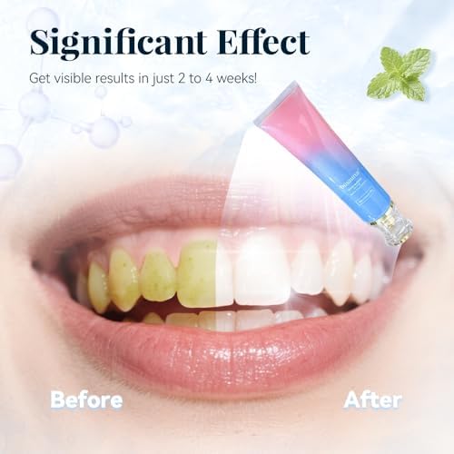 Busarus Toothpaste, Busarus Niacinamide Whitening Toothpaste, Fluoride-Free Whitening, with Coconut Oil & Xylitol, Freshen Breath (1)