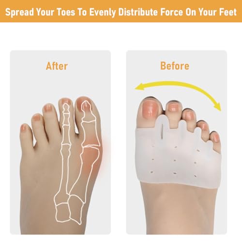 Hyggear Silicone Toe Separators with 2 Pairs Toe Socks for Women, Toe Straightener, Yoga Toes Toe Separators for Overlapping Toes to Foot Pressure Relief (2pairs toe separators + 2pairs toe socks)