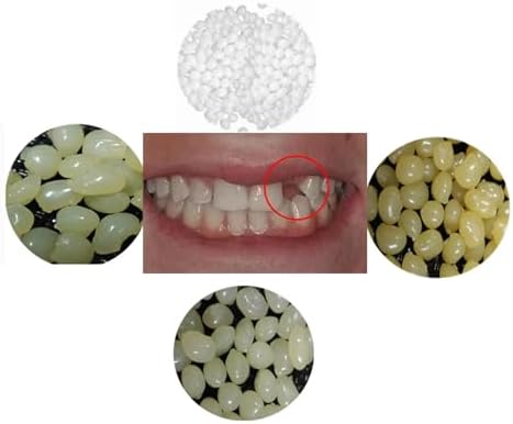 Latest 4 colors Temporary Moldable False Teeth Repair Replacement Thermal Fitting Beads Kit for Teeth Instant Confident Smile Teeth