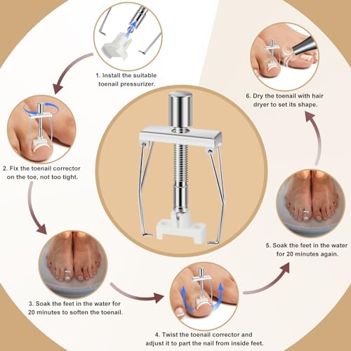 Ingrown Toenail Removal Kit, Professional Ingrown Toenail tool Kit with Ingrown Toenail Corrector, 50PCS Ingrown Toenail Corrector Patch & 30PCS Toenail Corrector Strips for Toe Pain Relief