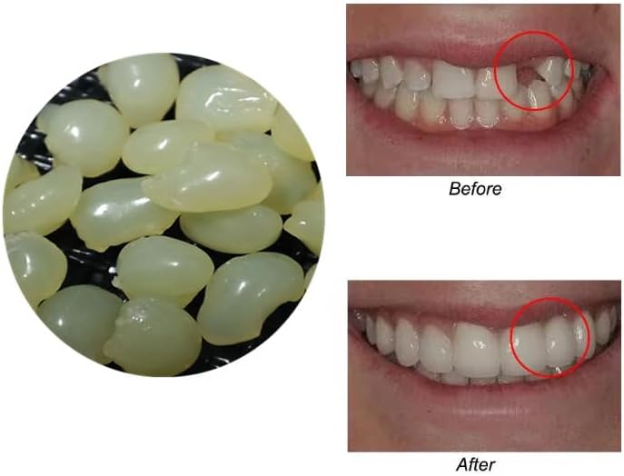Latest 4 colors Temporary Moldable False Teeth Repair Replacement Thermal Fitting Beads Kit for Teeth Instant Confident Smile Teeth
