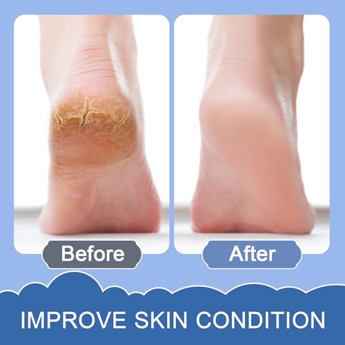 Hydrogen Bath Bombs for Women & Men, Hydrogen Bombs for Bath-Deep Hydration, Anti-Aging & Stress Relief, H2 Rich Water Spa for Skin Glow with Vanilla, Cinnamon & Orange, 3 Pcs