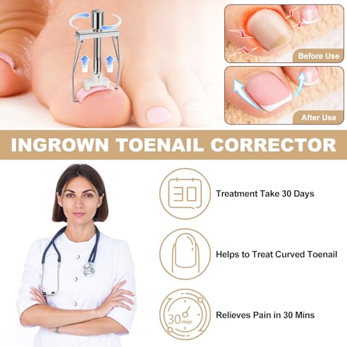 Ingrown Toenail Removal Kit, Professional Ingrown Toenail tool Kit with Ingrown Toenail Corrector, 50PCS Ingrown Toenail Corrector Patch & 30PCS Toenail Corrector Strips for Toe Pain Relief