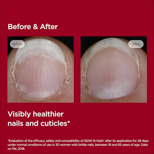 ISDIN Si-Nails - Fast Absorbing Nail Strengthening and Hardening Serum for Nail Durability in Thin Nails, made with Cationic Hyaluronic Acid 0.08 FL OZ