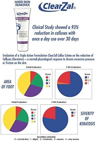 ClearZal Foot Cream For Hard Skin, Helps Calluses and Corn Removal While Leaving Soft Smooth Skin, Hydrating and Conditioning Triple Action Formula With Aloe Vera, 3.4 Ounce Tube