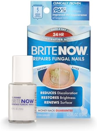 Brite Now Nail Treatment, Restores The Appearance Of Damaged & Discolored Nails, Peel-Away Technology, Brightening & Smoothing Nail Repair, 0.5 Ounce