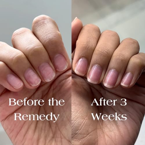 Botanist Nail Rescue Kit | Nail Strengthening Polish + Growth Serum | Grow and Strengthen Nails Damaged from Acrylics, Dip, and Gel Manicures | Non-Toxic, 84% Plant Based, 21-Free & Vegan (Rose)