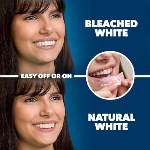 Imako Premium Cosmetic Uppers - 1 Pack - Small, Bleached White - DIY Smile Makeover - Made in USA