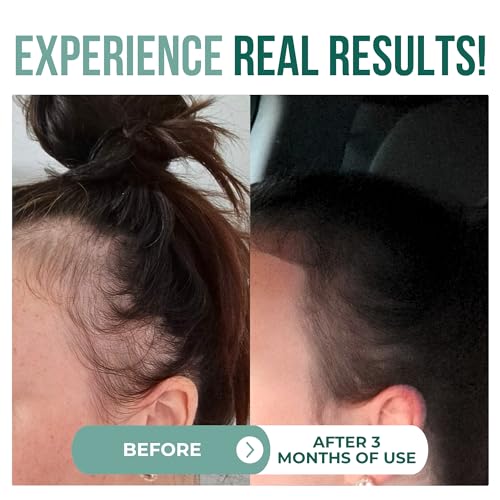 100% Organic Batana oil for Hair Growth | Pure Elaeis Oleifera | Natural Cold Press Extraction Method | Dr Sebi Scalp Care Hair Shine treatment for Men & Women | No Burnt Smell