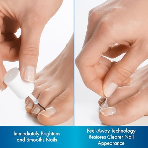 Brite Now Nail Treatment, Restores The Appearance Of Damaged & Discolored Nails, Peel-Away Technology, Brightening & Smoothing Nail Repair, 0.5 Ounce