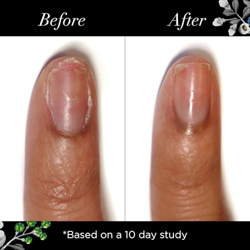 butter LONDON Nail Strengthener for Damaged Nails, Jelly Preserve - Translucent Finish Nail Polish Strengthens, Nourishes & Rejuvenates Nail Beds & Roots - Nail Care Products