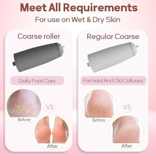 Callus Remover for Feet, ZABOUL Electric Foot Callus Remover Rechargeable Pedicure Tools Smooth Pedicure Wand Electronic Foot File, Feet Care for Removes Dry Hard & Dead Skin Ideal Gift