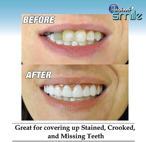Instant Smile Comfort Fit Flex - Bright Shade - Upper Veneer Cosmetic Teeth