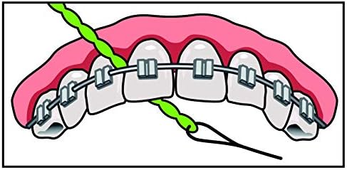 Brace X-Floss, Green