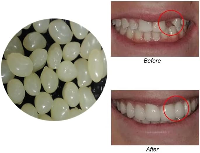 Latest 4 colors Temporary Moldable False Teeth Repair Replacement Thermal Fitting Beads Kit for Teeth Instant Confident Smile Teeth