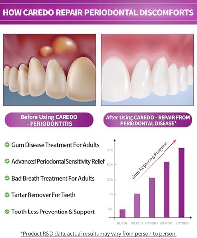 Gum Toothpaste for Periodontitis, Gum Repair for Receding Gums, Gum Disease & Gingivitis Treatment, Periodontal Disease Treatment for Gum Health, Gum Disease Repair Bad Breath Toothpaste 3.52OZ