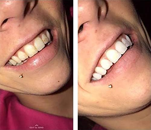 Color Wheel Teeth Whitener (Mint) Instantly Whitens Teeth. Easy to Use. 4 Ounce (Pack of 1)