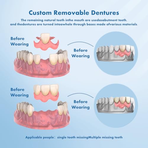 Custom Removable Dentures – Personalized Partial Denture Set for Tooth Replacement | 1–Multi-Tooth Coverage with Storage Case | Comfortable Wear for teeth (1 Tooth)