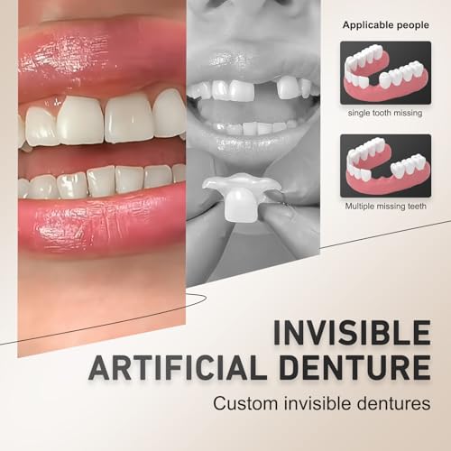 Custom Partial Dentures Removable Dentures, Portable Dental Prosthetics for Teeth (1 Tooth)