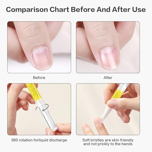 Brother Cosmetics Nail Growth & Repair Oil - Natural Rejuvenation, Instant Nail Strength (2PCS)