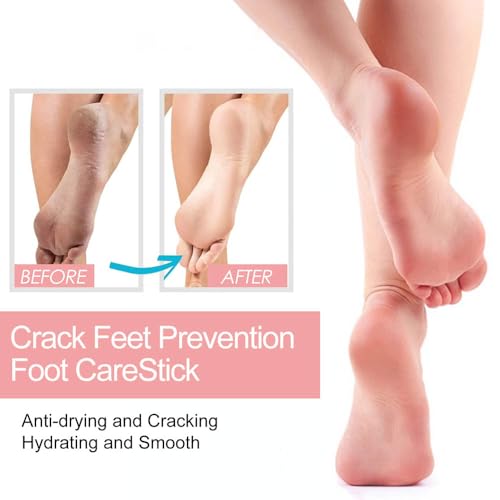 Crack Feet Prevention Stick, Anti Cracked Foot Cream For Dry Heels, Moisturizing Foot Balm Stick, Remove Dead Skin And Softening Dry Skin (Pink+Blue)
