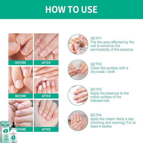 Kerassentials Toenail Oil, Kerassentials Nails colourless (3PCS)