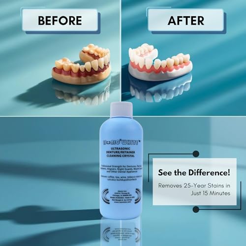 iSonic White CSDW01 Denture/Retainer Cleaning Crystal to Remove Stains, Buildups for all dental/sleep apnea/clear appliances, 8OZ bottle