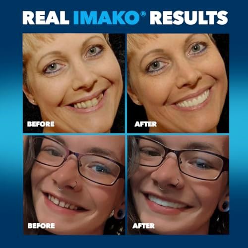 Imako Premium Cosmetic Uppers - 1 Pack - Small, Bleached White - DIY Smile Makeover - Made in USA