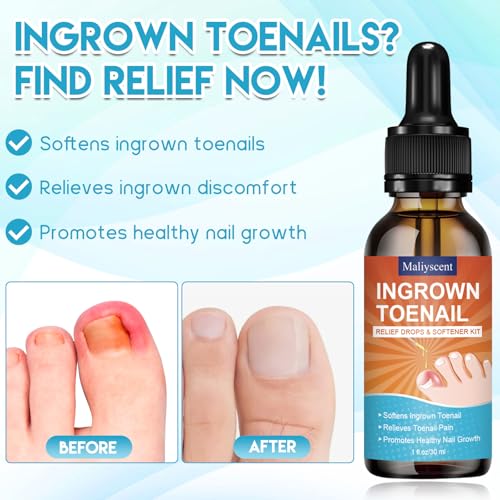 Ingrown Toenail Removal Kit, Professional Ingrown Toenail Tool Kit Includes Ingrown Toenail Corrector Drops, Corrector Patch, Toenail Clipper, Nail File Lifter Pedicure Tools