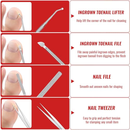 Ingrown Toenail Removal Kit, Ingrown Toenail Relief Tool Kit with Ingrown Toenail Corrector, Ingrown Toenail Drops, Corrector Patch, Toenail Clipper, Nail File Lifter Tools