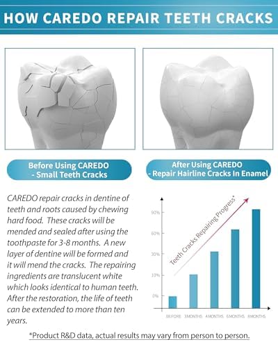 Healing Teeth Crack Toothpaste - Repairing Cracked Teeth Enamel, Remineralizing Toothpaste 100g