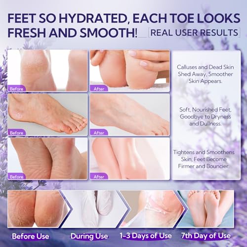 LANBENA Lavender Foot Peel Mask - Foot Peeling Mask for Removing Dry Dead Skin, Calluses & Repairing Rough Heels, for Baby Soft, Smooth Feet - (Lavender - 2 Pairs)