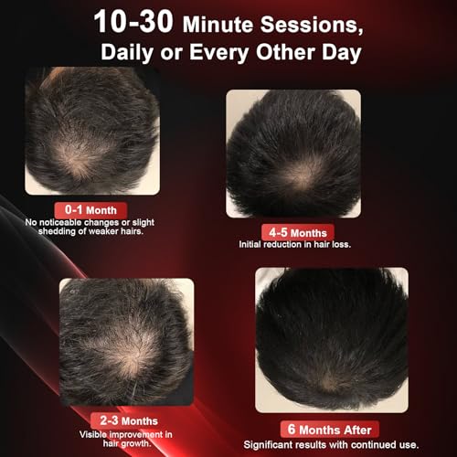 CAYAMA Laser Hair Growth Cap, 510 LEDs Red Light Cap for Fuller Looking Hair & Scalp Support for Men & Women