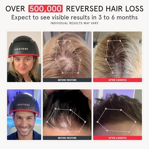 iRestore Elite - Laser Red Light Therapy for Hair Growth System - FDA Cleared Hair Loss, Hair Thinning & Alopecia Treatment for Men & Women - Laser Cap for Hair Regrowth Stimulates Denser Fuller Hair