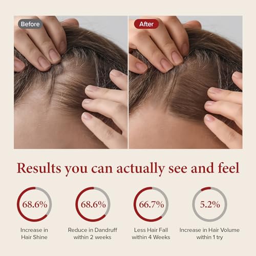 KUNDAL Korean Caffeine Scalp Shampoo [Cherry Blossom] – Sulfate-Free Hair Care with Menthol & Botanical Extracts – For Fuller-Looking Hair, Scalp Refresh & Strength – 16.9 Fl Oz